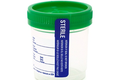 Sterile Urine Cup