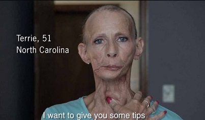 CDC Anti-Smoking Ad 8-7-12