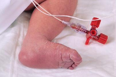 Baby foot-hospital