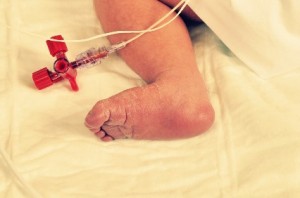Baby foot-hospital July 282C2011